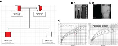 Understanding the Mechanism of Dysglycemia in a Fanconi-Bickel Syndrome Patient